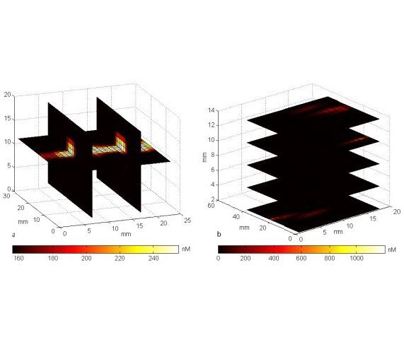 Ultrasound Guided Fluorescence Tomography