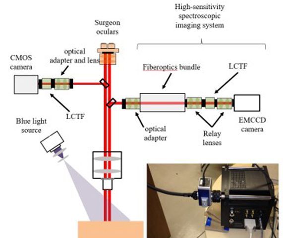 Improved sensitivity to fluorescence for cancer detection in wide-field image-guided neurosurgery