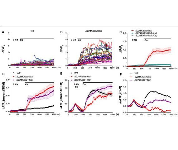 Spontaneous Ca2+ Influx in Drosophila Pupal Neurons Is Modulated by IP3-Receptor Function and Influences Maturation of the Flight Circuit