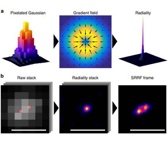 Fast live-cell conventional fluorophore nanoscopy with ImageJ through super-resolution radial fluctuations