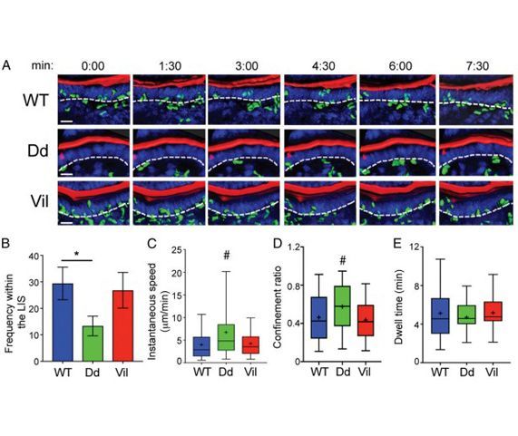 Epithelial IL-15 Is a Critical Regulator of γδ Intraepithelial Lymphocyte Motility within the Intestinal Mucosa