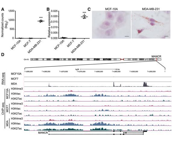 Mitotically-Associated lncRNA (MANCR) Affects Genomic Stability and Cell Division in Aggressive Breast Cancer